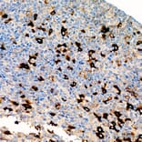 Immunohistochemistry - Anti-HCG alpha Antibody (A329426) - Antibodies.com