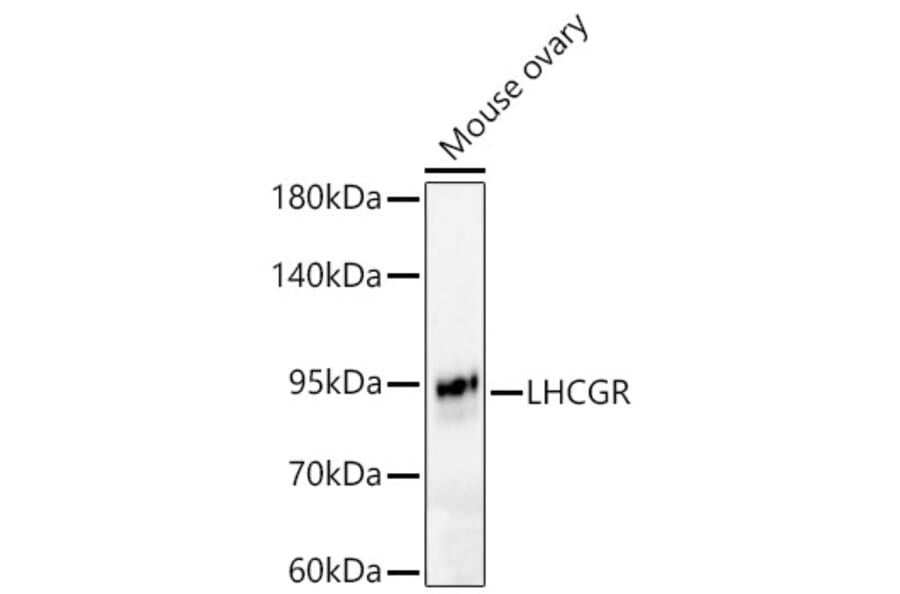 Western Blot - Anti-LHR Antibody (A329427) - Antibodies.com