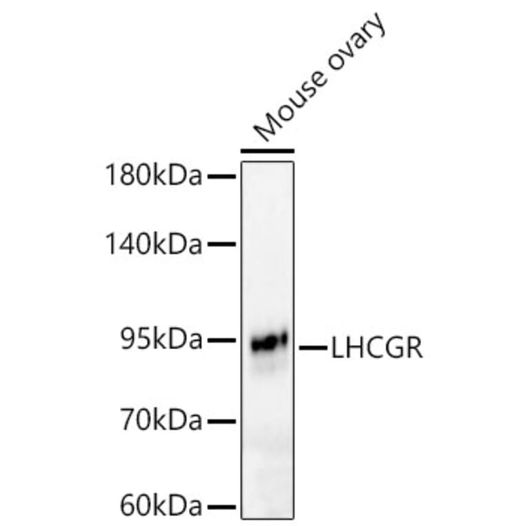 Western Blot - Anti-LHR Antibody (A329427) - Antibodies.com