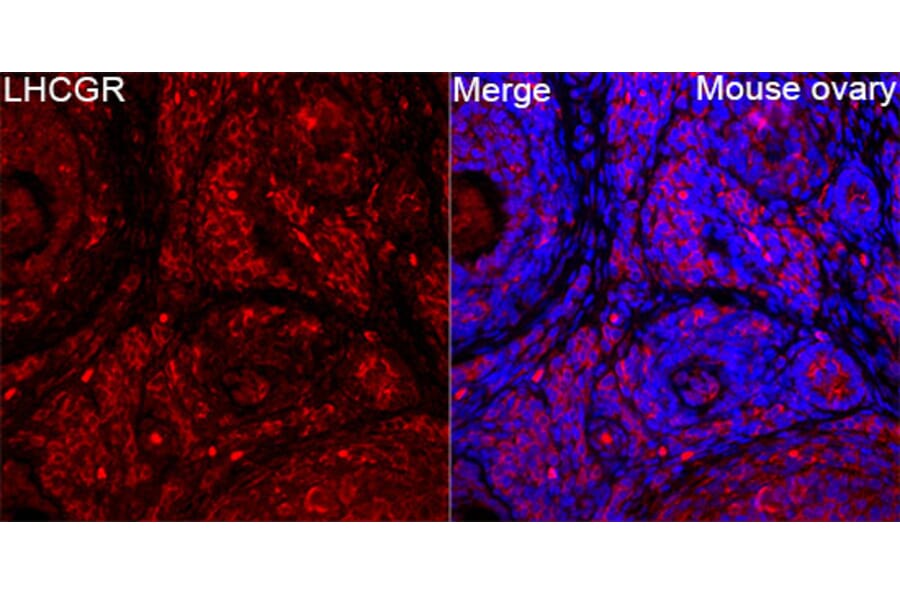 Immunofluorescence - Anti-LHR Antibody (A329427) - Antibodies.com