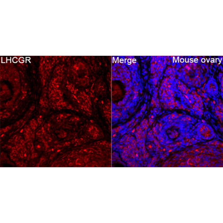 Immunofluorescence - Anti-LHR Antibody (A329427) - Antibodies.com