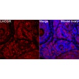 Immunofluorescence - Anti-LHR Antibody (A329427) - Antibodies.com