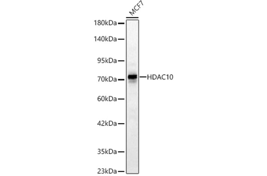 Western Blot - Anti-HDAC10 Antibody (A329428) - Antibodies.com