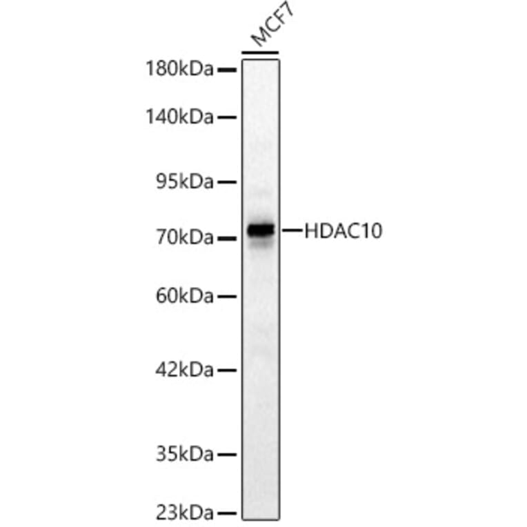 Western Blot - Anti-HDAC10 Antibody (A329428) - Antibodies.com