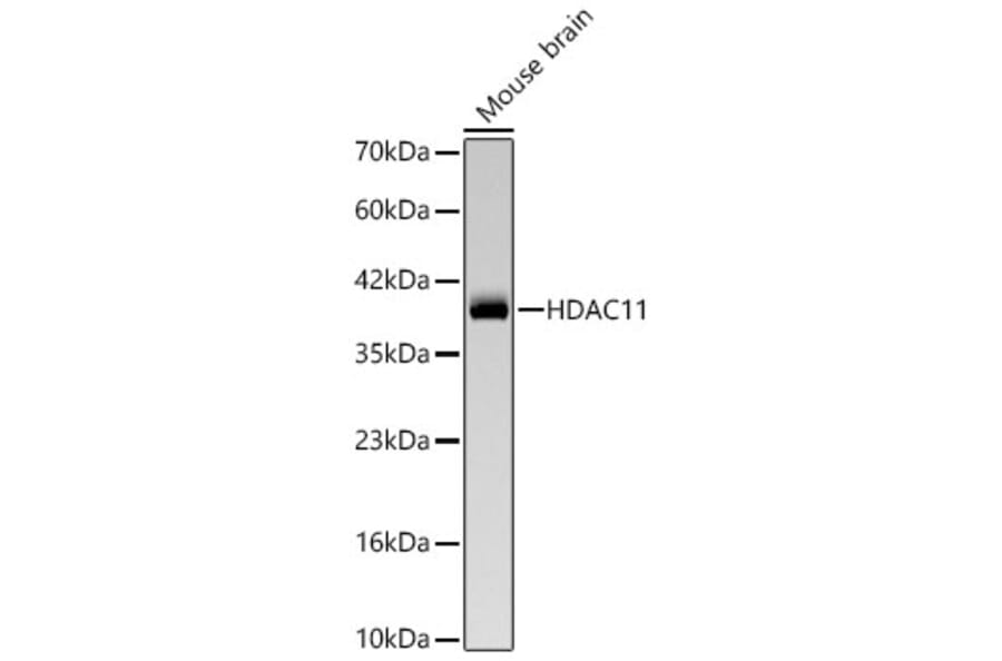 Western Blot - Anti-HDAC11 Antibody [ARC66199] (A329429) - Antibodies.com