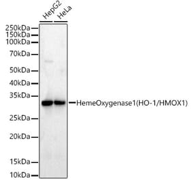 Western Blot - Anti-Heme Oxygenase 1 Antibody [ARC53510] (A329432) - Antibodies.com