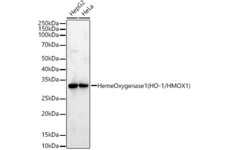 Western Blot - Anti-Heme Oxygenase 1 Antibody [ARC53510] (A329432) - Antibodies.com