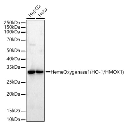 Western Blot - Anti-Heme Oxygenase 1 Antibody [ARC53510] (A329432) - Antibodies.com
