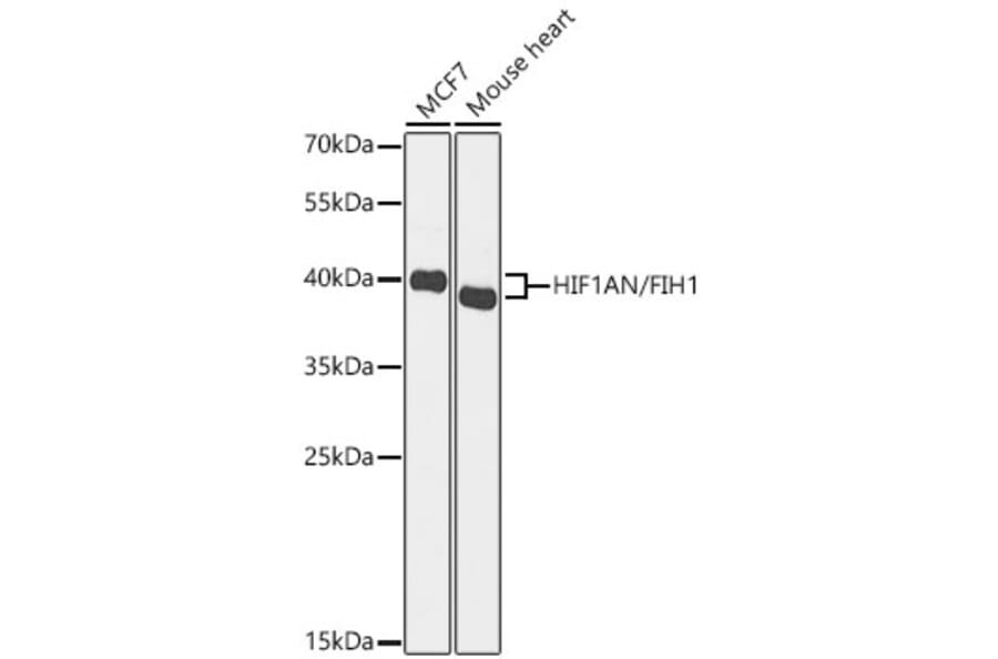 Western Blot - Anti-HIF1AN Antibody (A329435) - Antibodies.com