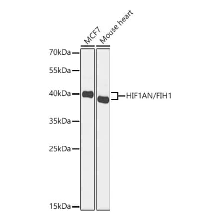 Western Blot - Anti-HIF1AN Antibody (A329435) - Antibodies.com