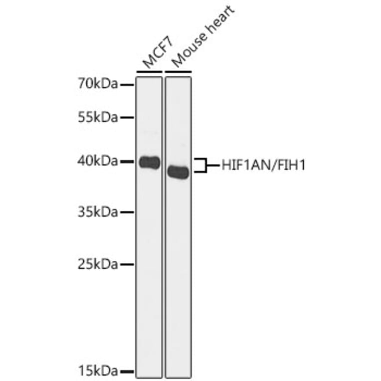 Western Blot - Anti-HIF1AN Antibody (A329435) - Antibodies.com