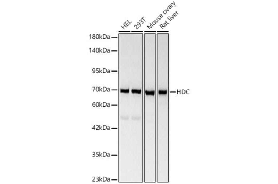 Western Blot - Anti-Histidine Decarboxylase Antibody (A329436) - Antibodies.com