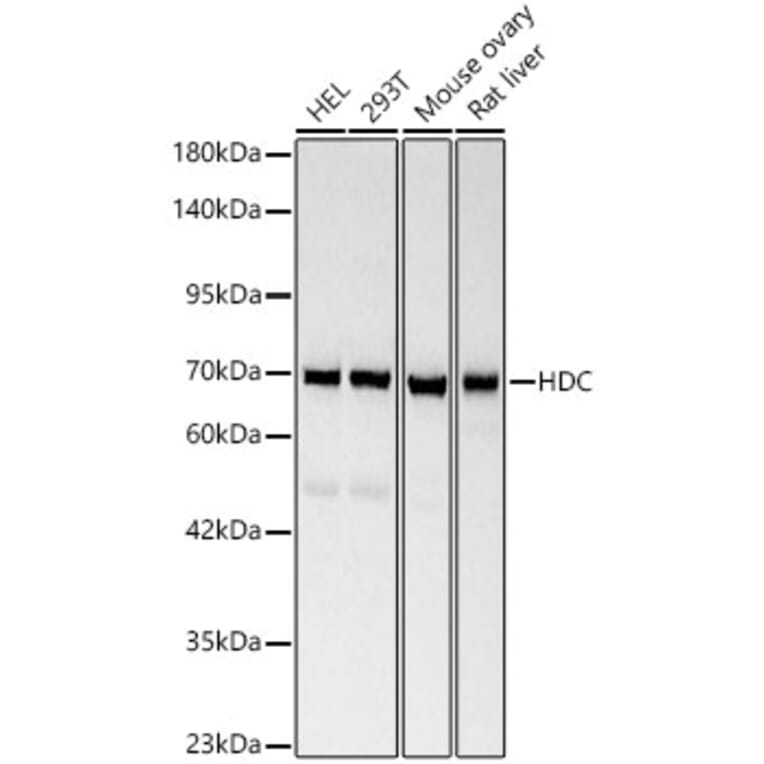 Western Blot - Anti-Histidine Decarboxylase Antibody (A329436) - Antibodies.com
