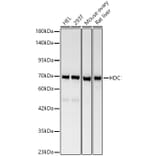 Western Blot - Anti-Histidine Decarboxylase Antibody (A329436) - Antibodies.com