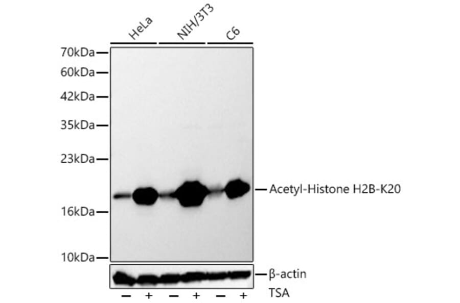 Western Blot - Anti-Histone H2B Antibody (A329437) - Antibodies.com