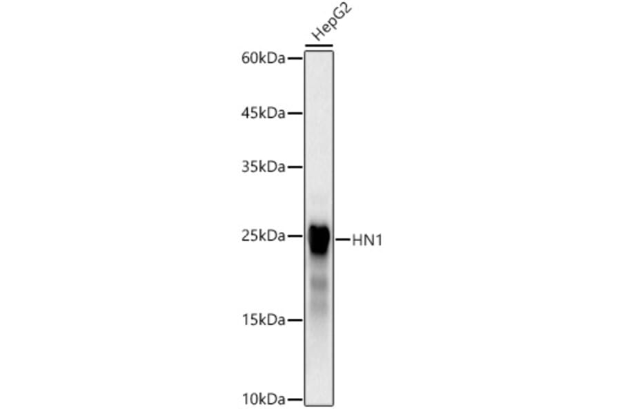 Western Blot - Anti-HN1 Antibody [ARC3106] (A329439) - Antibodies.com