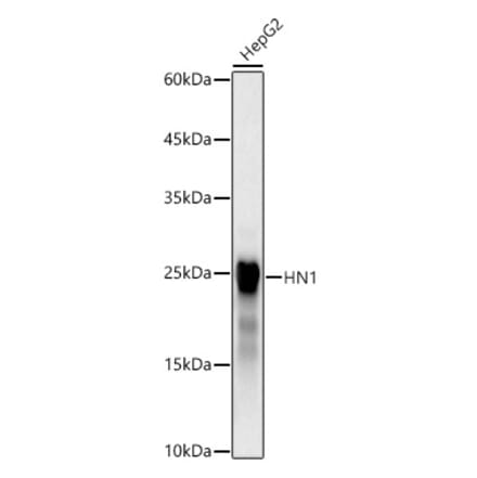 Western Blot - Anti-HN1 Antibody [ARC3106] (A329439) - Antibodies.com
