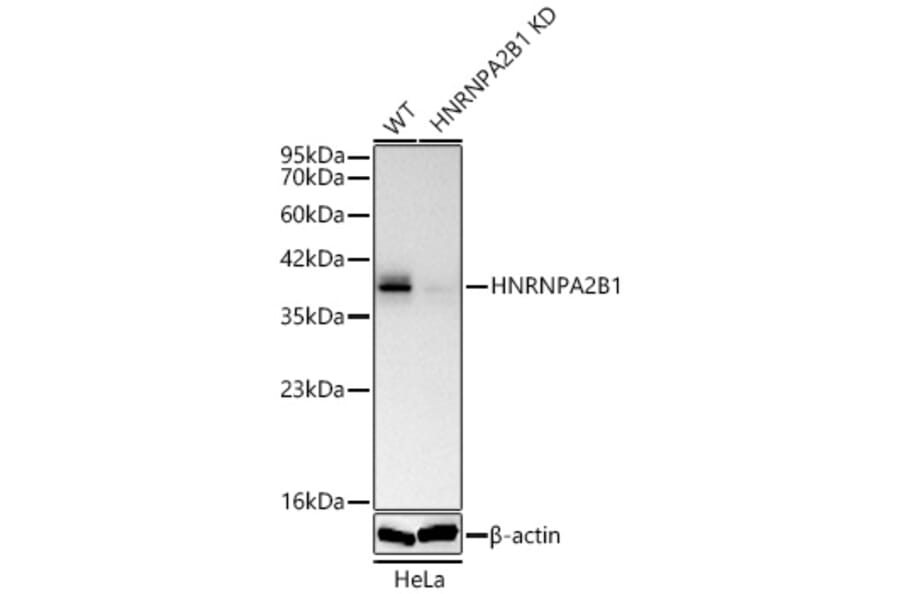 Western Blot - Anti-hnRNP A2B1 Antibody (A329440) - Antibodies.com