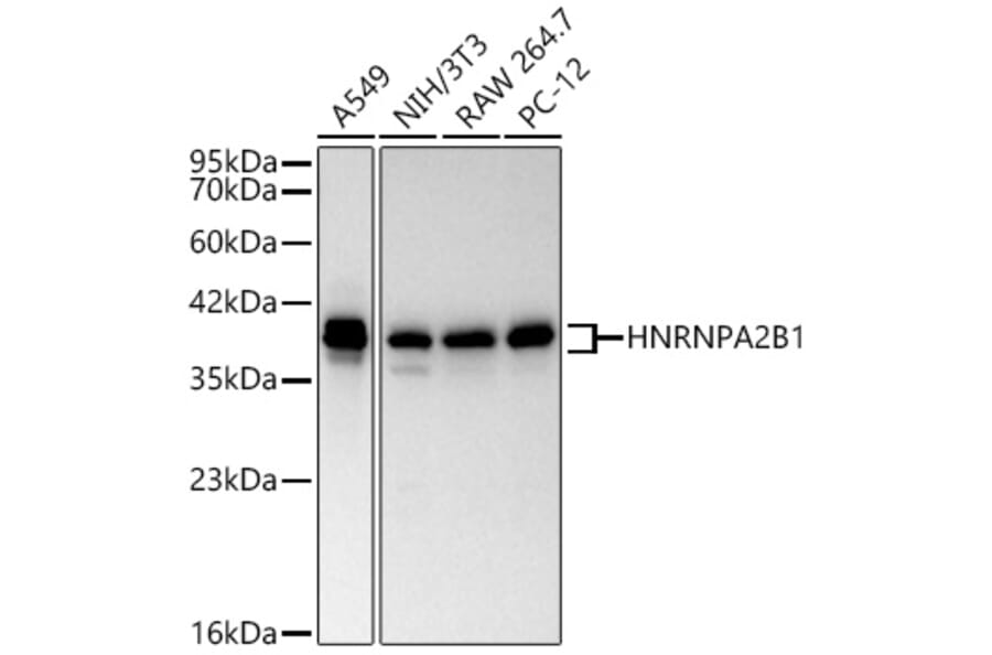 Western Blot - Anti-hnRNP A2B1 Antibody (A329440) - Antibodies.com