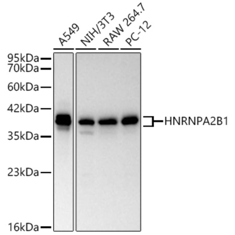 Western Blot - Anti-hnRNP A2B1 Antibody (A329440) - Antibodies.com