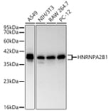 Western Blot - Anti-hnRNP A2B1 Antibody (A329440) - Antibodies.com
