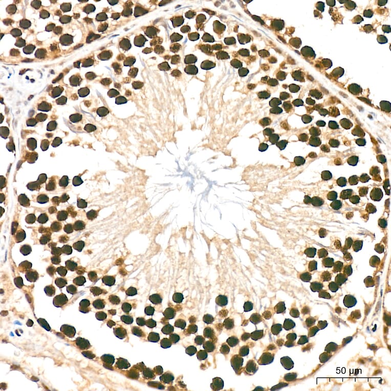 Immunohistochemistry - Anti-hnRNP A2B1 Antibody (A329440) - Antibodies.com