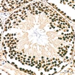 Immunohistochemistry - Anti-hnRNP A2B1 Antibody (A329440) - Antibodies.com