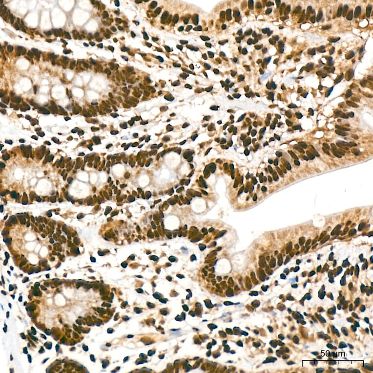 Immunohistochemistry - Anti-hnRNP A2B1 Antibody (A329440) - Antibodies.com