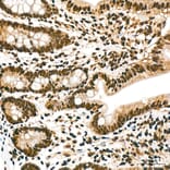 Immunohistochemistry - Anti-hnRNP A2B1 Antibody (A329440) - Antibodies.com