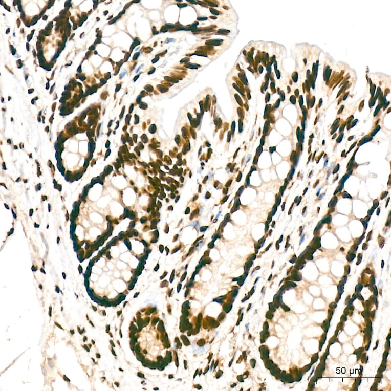 Immunohistochemistry - Anti-hnRNP A2B1 Antibody (A329440) - Antibodies.com