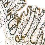 Immunohistochemistry - Anti-hnRNP A2B1 Antibody (A329440) - Antibodies.com