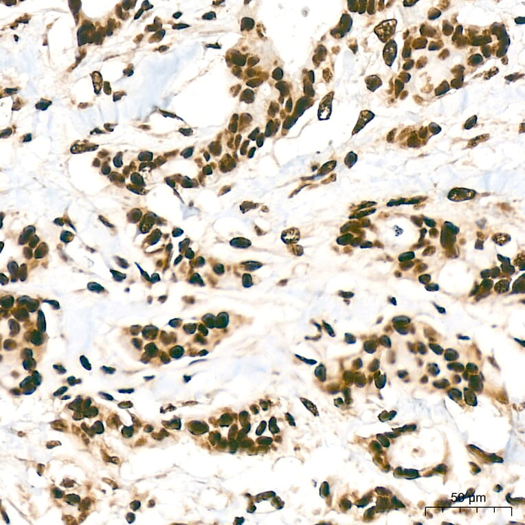 Immunohistochemistry - Anti-hnRNP A2B1 Antibody (A329440) - Antibodies.com