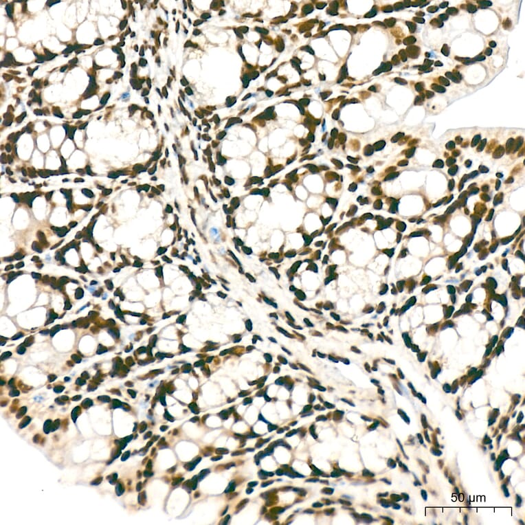 Immunohistochemistry - Anti-hnRNP A2B1 Antibody (A329440) - Antibodies.com