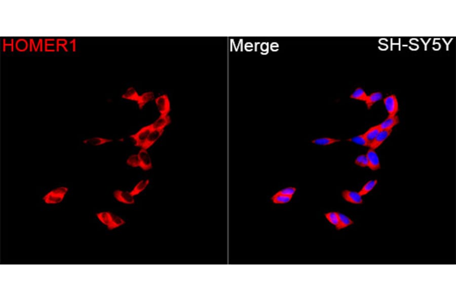 Immunofluorescence - Anti-HOMER1 Antibody (A329442) - Antibodies.com