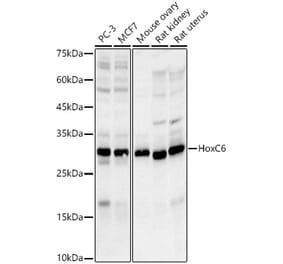 Western Blot - Anti-HoxC6 Antibody [ARC3119] (A329443) - Antibodies.com