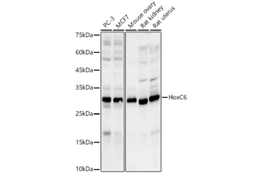 Western Blot - Anti-HoxC6 Antibody [ARC3119] (A329443) - Antibodies.com