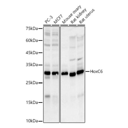 Western Blot - Anti-HoxC6 Antibody [ARC3119] (A329443) - Antibodies.com