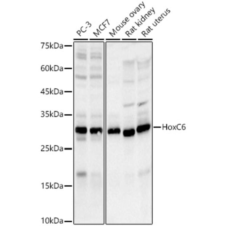 Western Blot - Anti-HoxC6 Antibody [ARC3119] (A329443) - Antibodies.com
