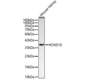 Western Blot - Anti-HOXD10 Antibody [ARC62112] (A329444) - Antibodies.com