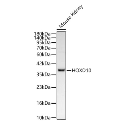 Western Blot - Anti-HOXD10 Antibody [ARC62112] (A329444) - Antibodies.com