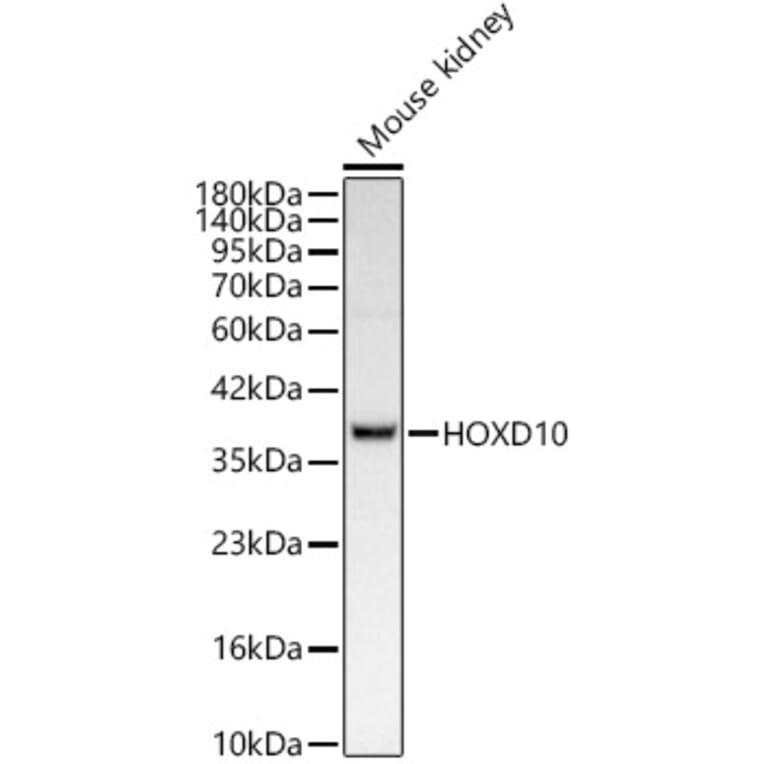 Western Blot - Anti-HOXD10 Antibody [ARC62112] (A329444) - Antibodies.com