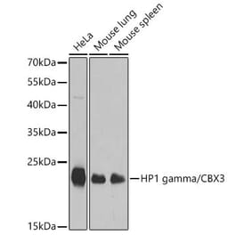 Western Blot - Anti-CBX3 Antibody (A329445) - Antibodies.com