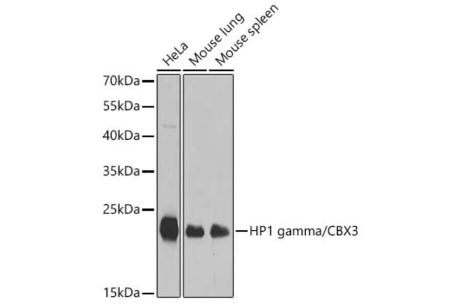 Western Blot - Anti-CBX3 Antibody (A329445) - Antibodies.com
