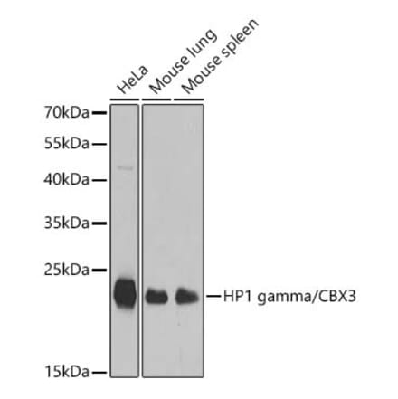 Western Blot - Anti-CBX3 Antibody (A329445) - Antibodies.com