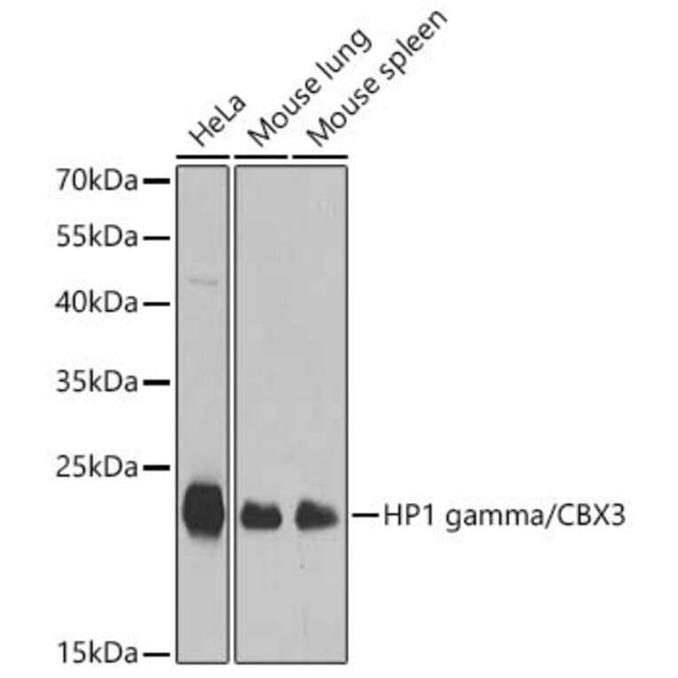 Western Blot - Anti-CBX3 Antibody (A329445) - Antibodies.com