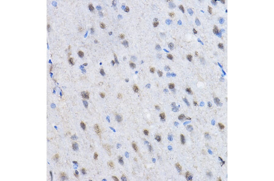 Immunohistochemistry - Anti-CBX3 Antibody (A329445) - Antibodies.com
