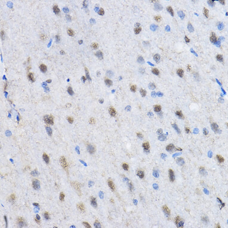 Immunohistochemistry - Anti-CBX3 Antibody (A329445) - Antibodies.com
