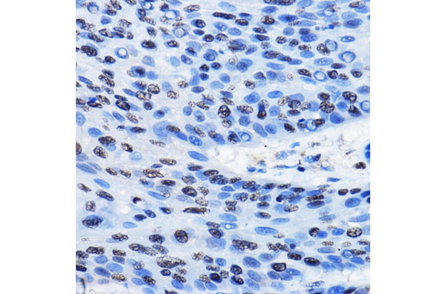 Immunohistochemistry - Anti-CBX3 Antibody (A329445) - Antibodies.com