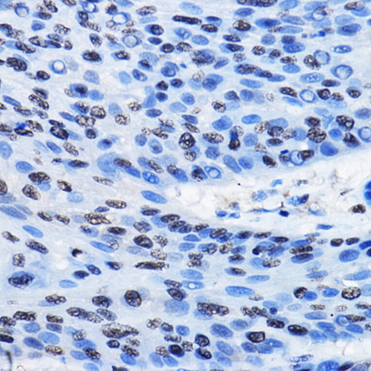 Immunohistochemistry - Anti-CBX3 Antibody (A329445) - Antibodies.com