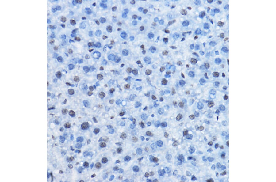 Immunohistochemistry - Anti-CBX3 Antibody (A329445) - Antibodies.com